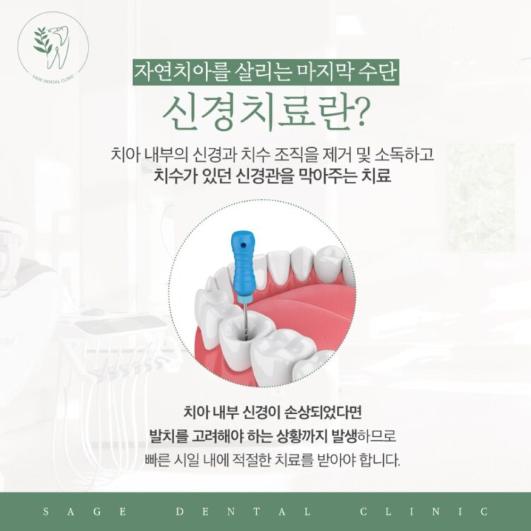 약수역신경치료