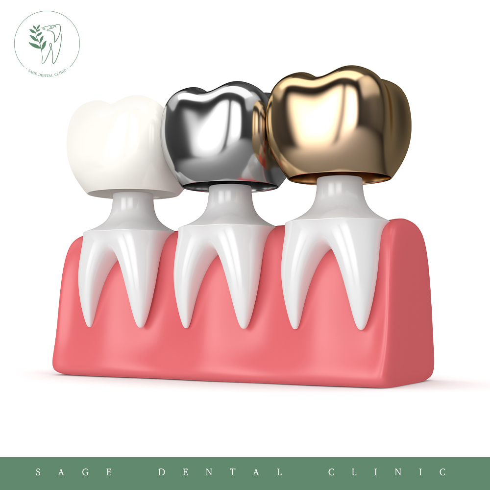 신당동충치치료