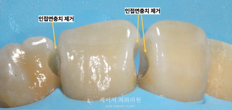 약수역치과