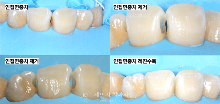 약수역치과