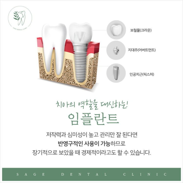 신당동임플란트