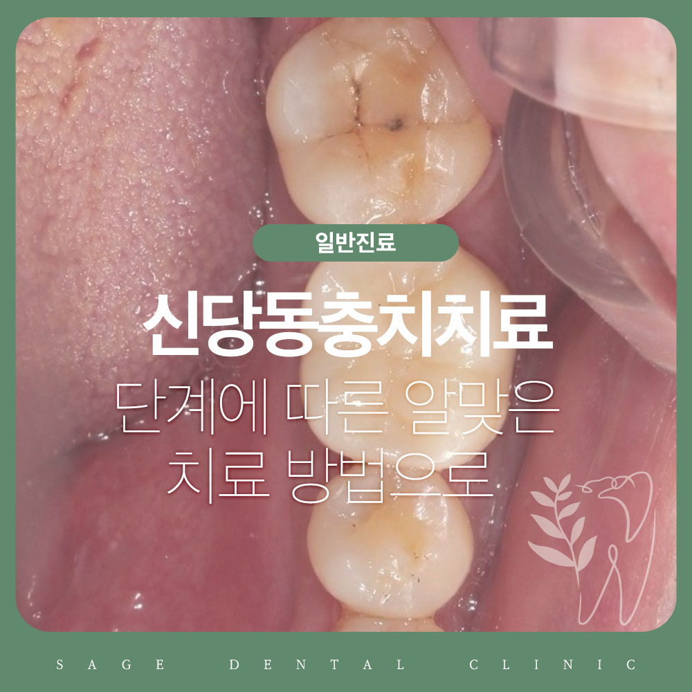 신당동충치치료