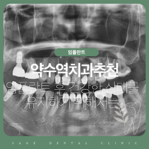 약수역치과추천, 임플란트 후 건강한 상태를 유지하기 위해서는
