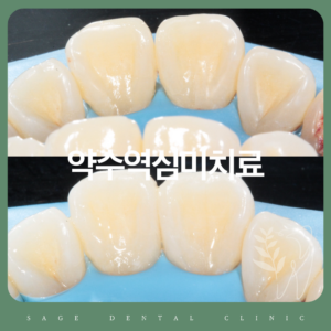 약수역심미치료