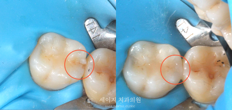 약수역심미치료