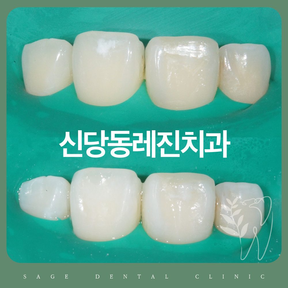 신당동레진치과