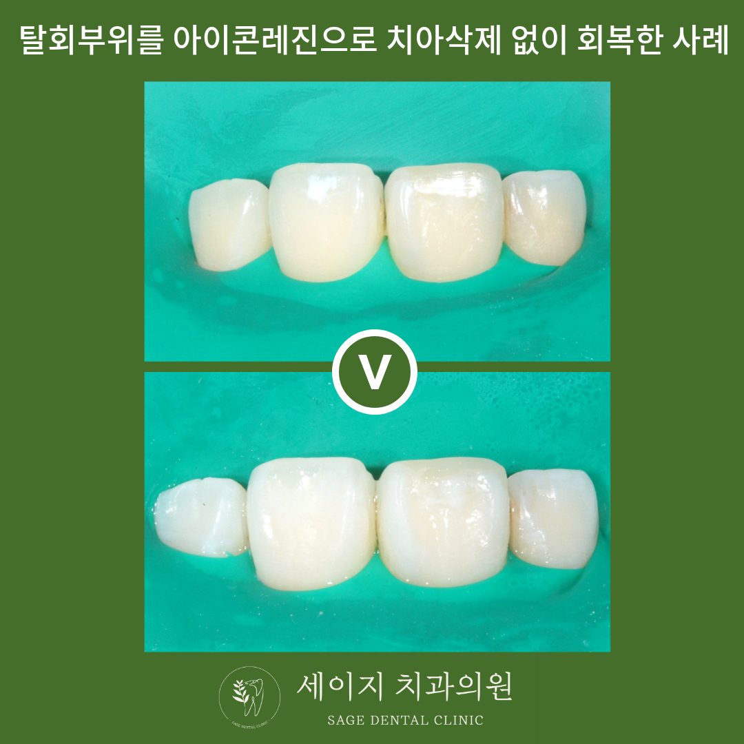 신당동레진치과